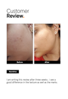 AHA PHA BHA 32% Face Peel