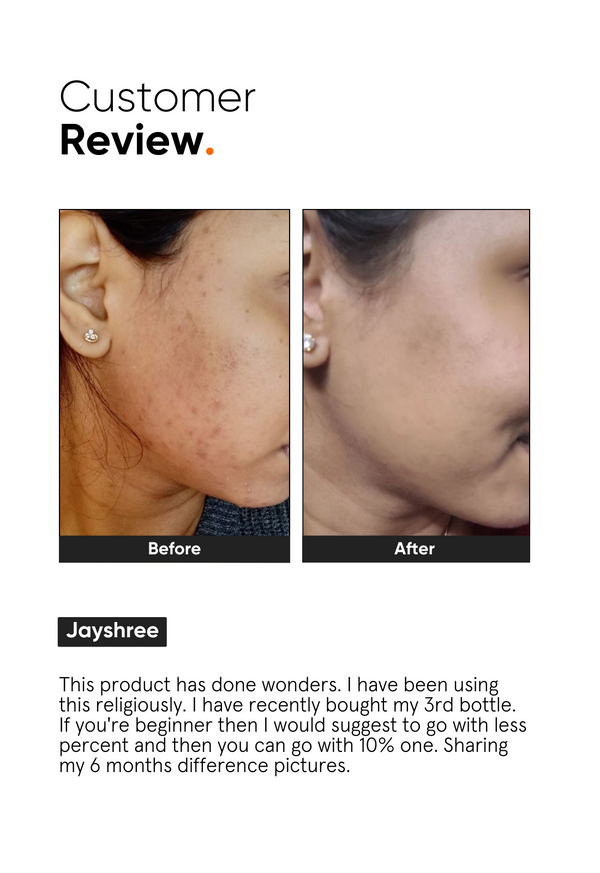 Niacinamide 10% Face Serum