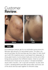 Salicylic Acid + LHA 2% Cleanser
